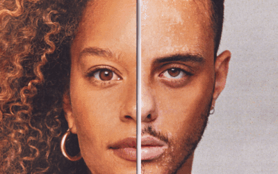 Gender Modification and Bone Health: Understanding the Impact of Hormone Therapy on Bone Density