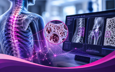 Breaking IT Down – How AI Is Changing the Way We Find and Prevent Broken Bones